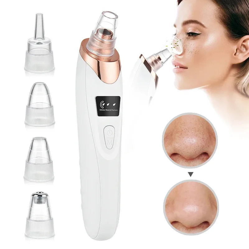 Electric Blackhead Remover Vacuum Acne Cleaner for Deep Pore Cleansing